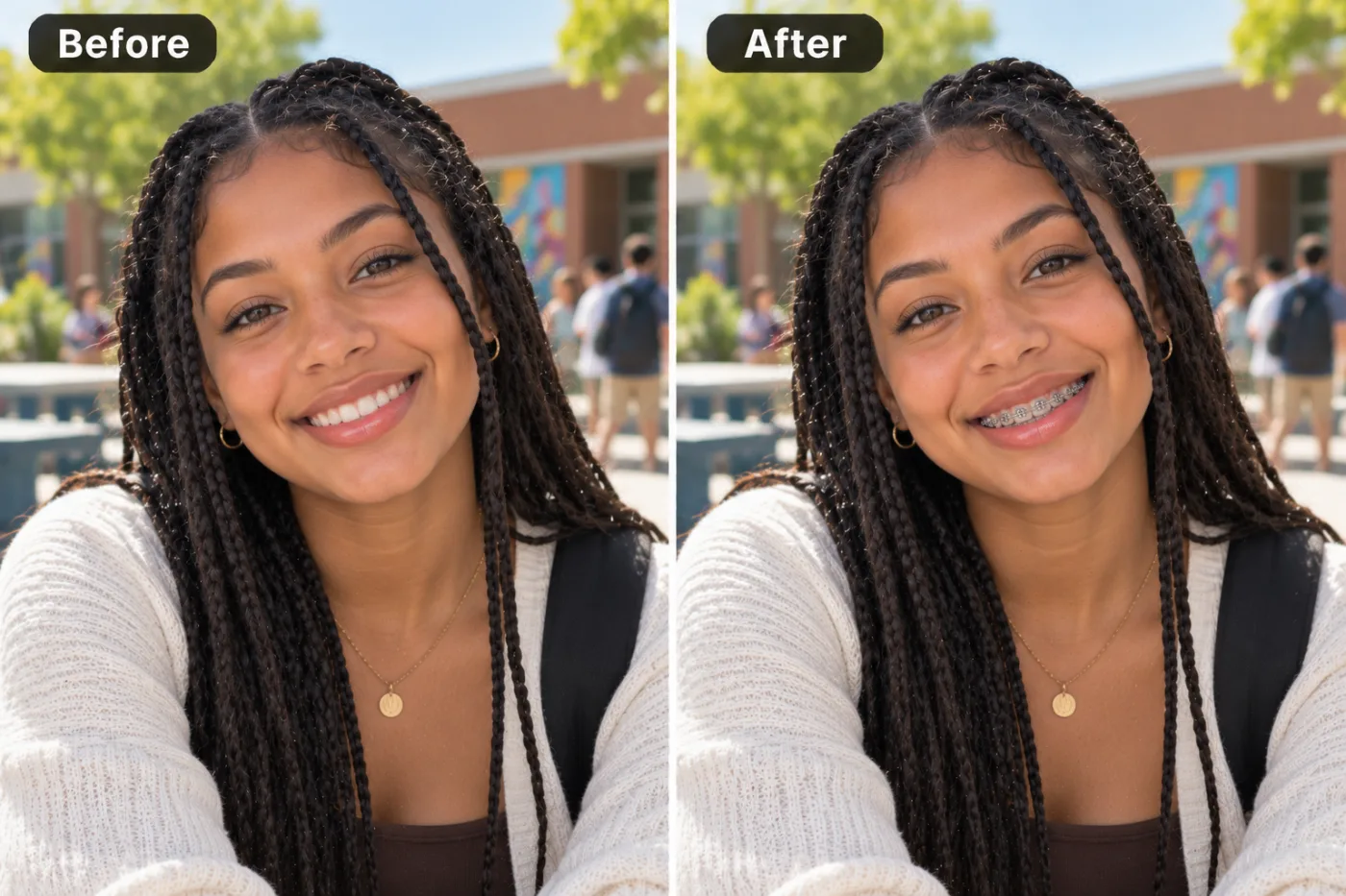 Braces Filter — before and after